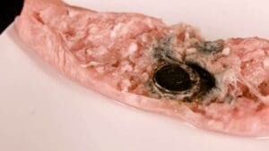 أضرار ابتلاع البطاريات التي قد تؤدي إلي حدوث وفاة للأطفال